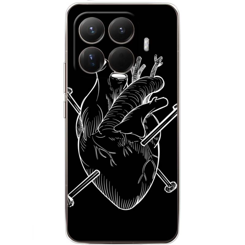 Чохол BoxFace Xiaomi 15T Pro 