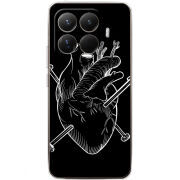 Чохол BoxFace Xiaomi 15T Pro 