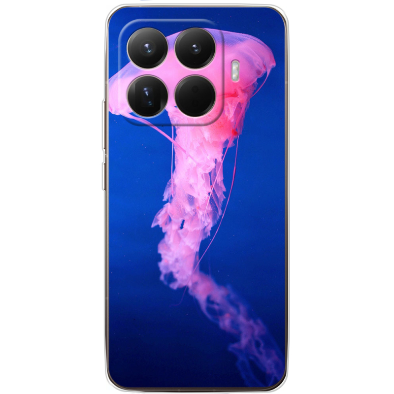 Чохол BoxFace Xiaomi 15T Pro