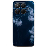 Чохол BoxFace Xiaomi 15T Pro 