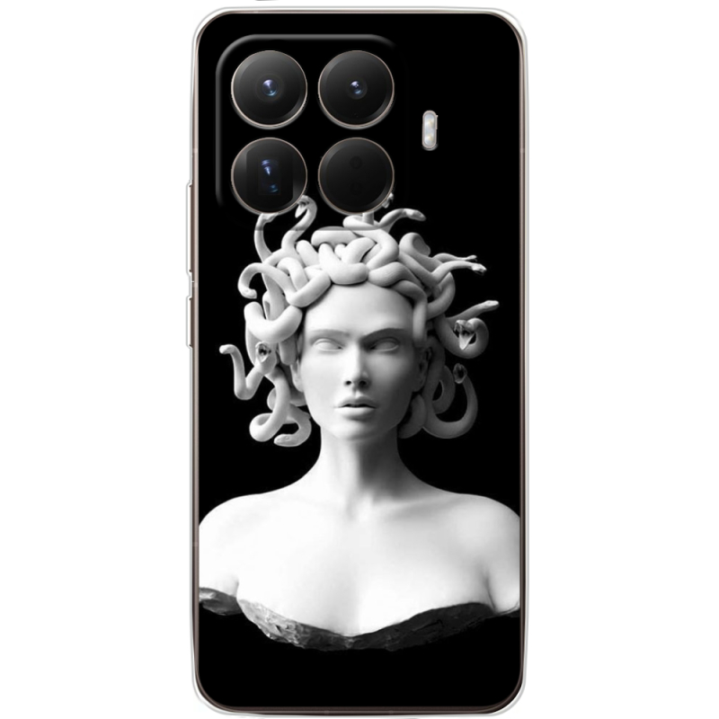 Чохол BoxFace Xiaomi 15T Pro