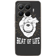 Чохол BoxFace Xiaomi 15T Pro 