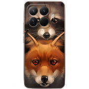 Чохол BoxFace Xiaomi 15T Pro 