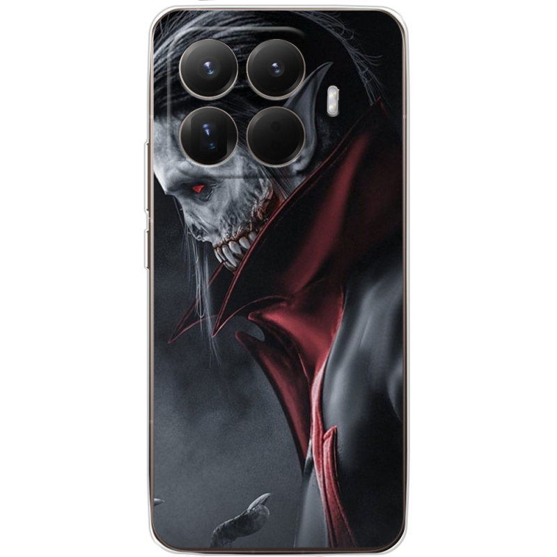 Чохол BoxFace Xiaomi 15T Pro