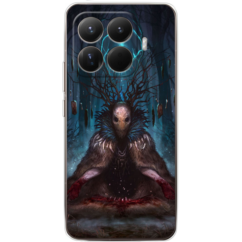 Чохол BoxFace Xiaomi 15T Pro