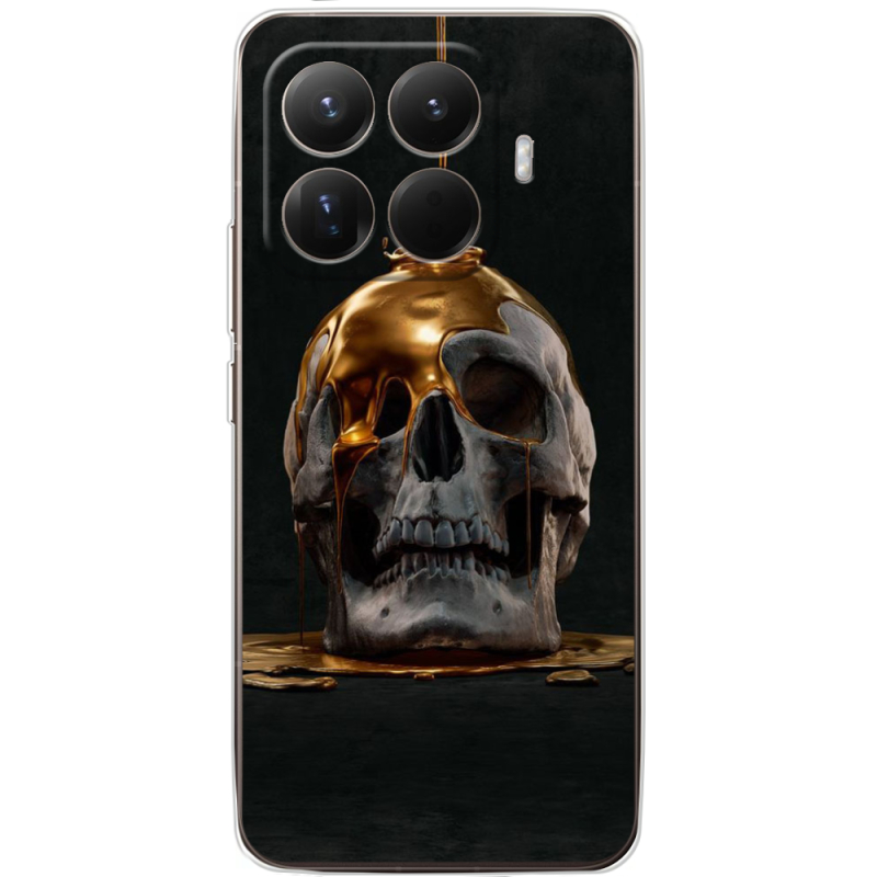 Чохол BoxFace Xiaomi 15T Pro