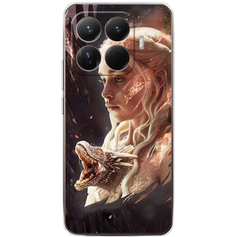 Чохол BoxFace Xiaomi 15T Pro