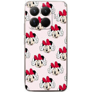 Чохол BoxFace Xiaomi 15T Pro 