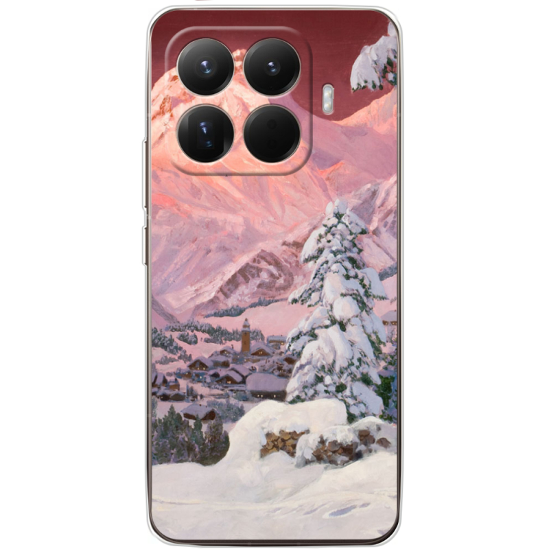 Чохол BoxFace Xiaomi 15T Pro