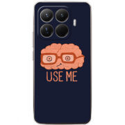 Чохол BoxFace Xiaomi 15T Pro 