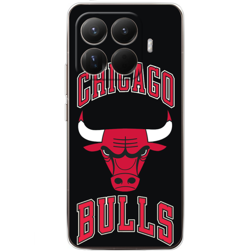 Чохол BoxFace Xiaomi 15T Pro