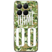 Чохол BoxFace Xiaomi 15T Pro 