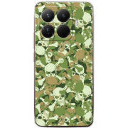 Чохол BoxFace Xiaomi 15T Pro 