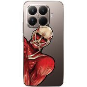 Прозорий чохол BoxFace Xiaomi 15T Pro Титан