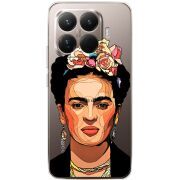 Прозорий чохол BoxFace Xiaomi 15T Pro Фрида Кало