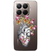 Чохол зі стразами Xiaomi 15T Pro Heart