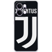 Чохол BoxFace OPPO Reno 14 5G FC J