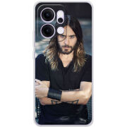 Чохол BoxFace OPPO Reno 14 5G 