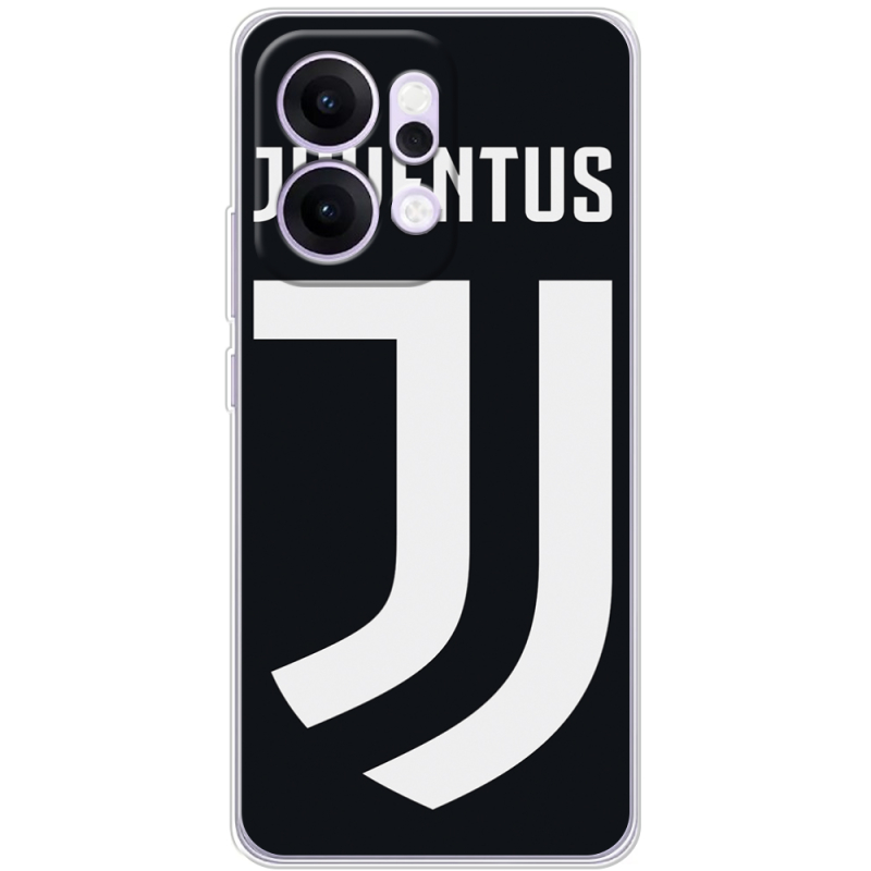 Чохол BoxFace OPPO Reno 14 Pro 5G FC J