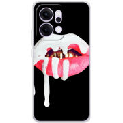 Чохол BoxFace OPPO Reno 14 Pro 5G 