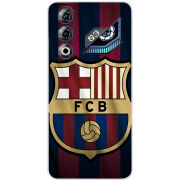 Чохол BoxFace Nubia Neo 3 GT 5G 