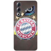 Чохол BoxFace Nubia Neo 3 GT 5G 