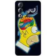 Чохол BoxFace Nubia Neo 3 GT 5G 