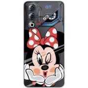 Прозорий чохол BoxFace Nubia Neo 3 GT 5G Lady M