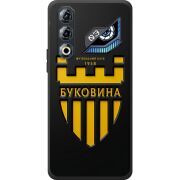 Чорний чохол BoxFace Nubia Neo 3 GT 5G 
