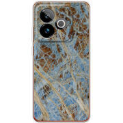 Чохол BoxFace Realme GT 7 5G 