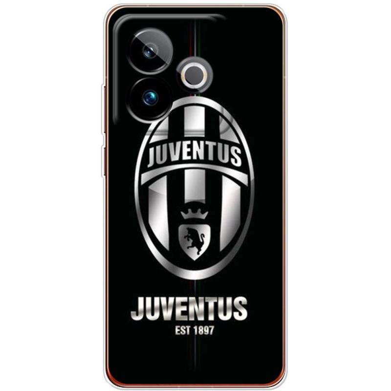 Чохол BoxFace Realme GT 7 5G 