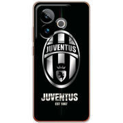 Чохол BoxFace Realme GT 7 5G 