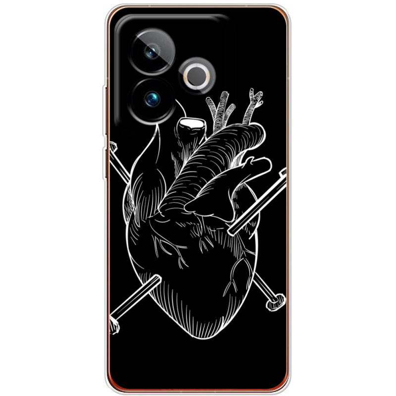 Чохол BoxFace Realme GT 7 5G 