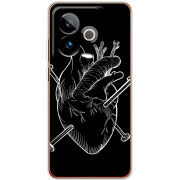 Чохол BoxFace Realme GT 7 5G 