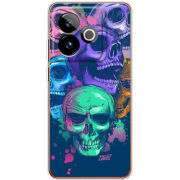 Чохол BoxFace Realme GT 7T 5G 