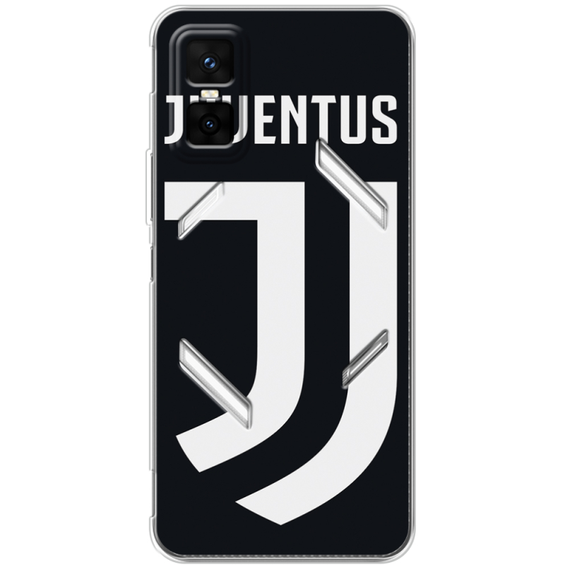 Чохол BoxFace Infinix GT 30 Pro FC J