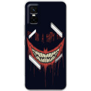 Чохол BoxFace Infinix GT 30 Pro 