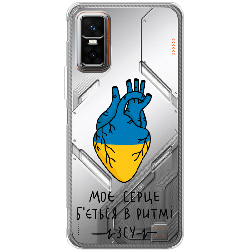 Прозорий чохол BoxFace Infinix GT 30 Pro Моє серце в ритмі ЗСУ