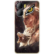 Чохол BoxFace Nubia Neo 3 5G 