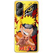 Прозорий чохол BoxFace Nubia Neo 3 5G Naruto
