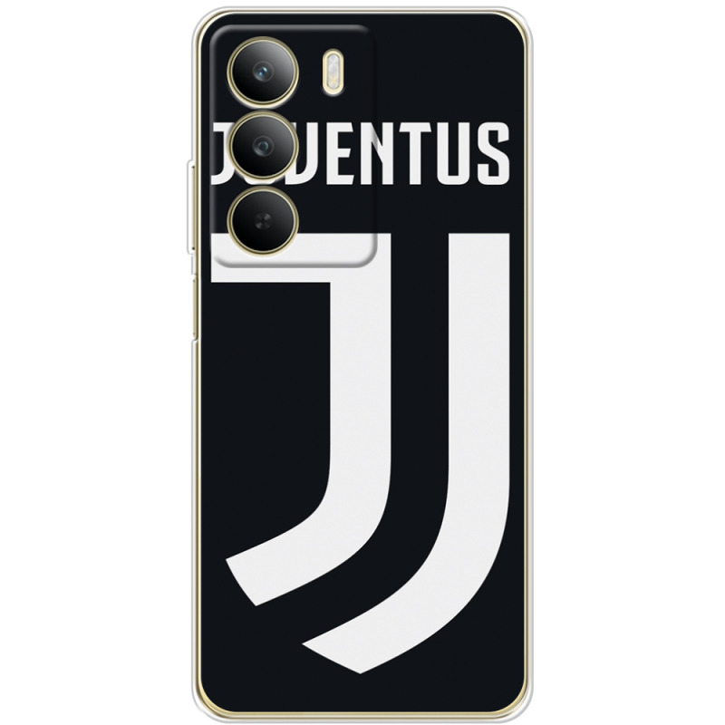 Чохол BoxFace Realme C71 FC J