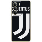 Чохол BoxFace Realme C71 FC J