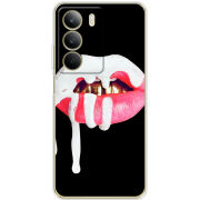 Чохол BoxFace Realme C71 