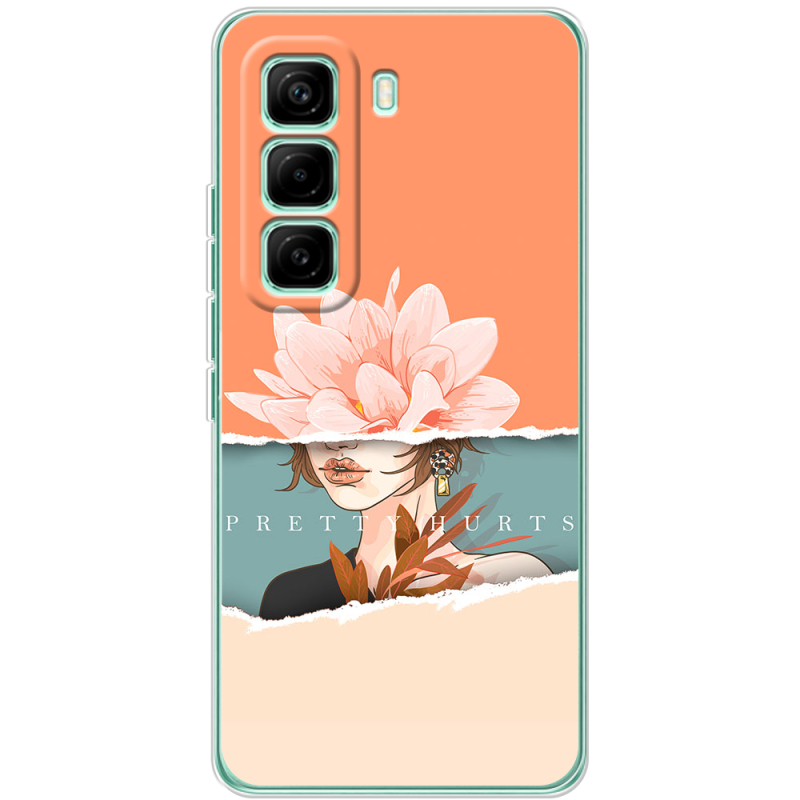 Чохол BoxFace Infinix Hot 60 Pro 