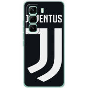 Чохол BoxFace Infinix Hot 60 Pro FC J