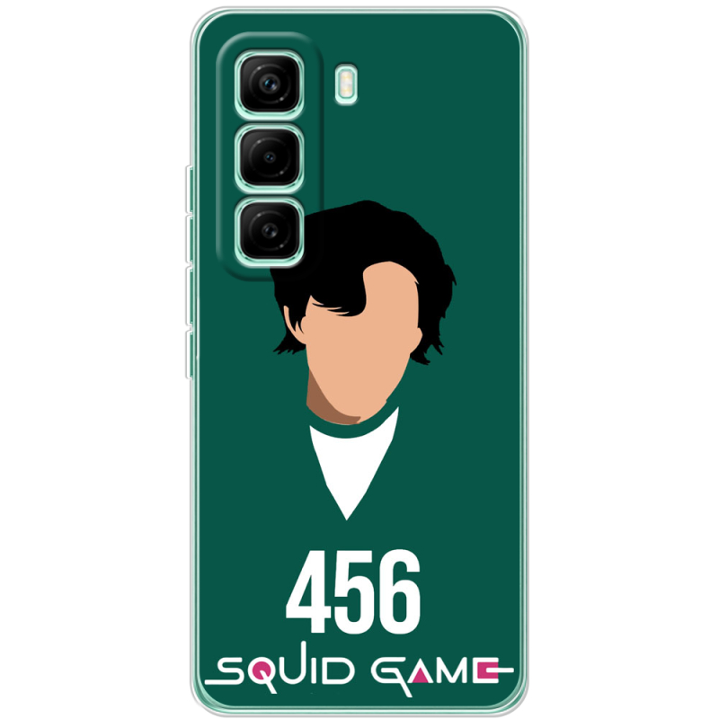 Чохол BoxFace Infinix Hot 60 Pro siquid game 456