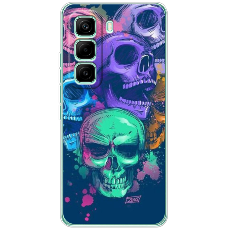 Чохол BoxFace Infinix Hot 60 Pro 