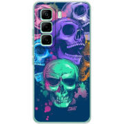 Чохол BoxFace Infinix Hot 60 Pro 