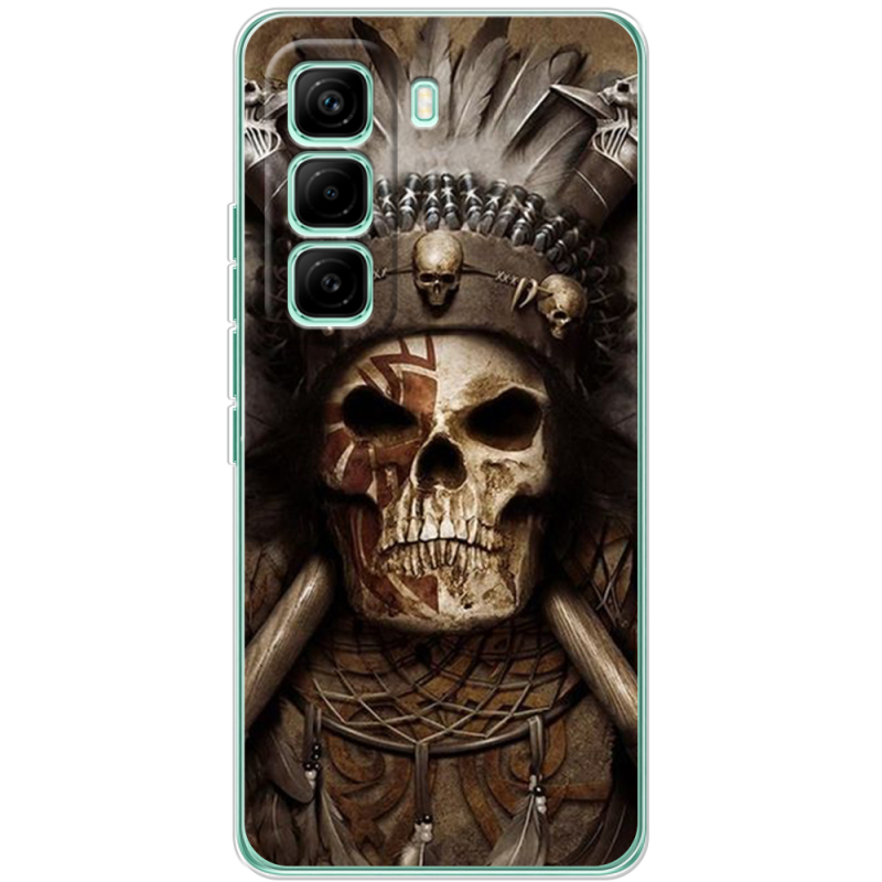 Чохол BoxFace Infinix Hot 60 Pro 