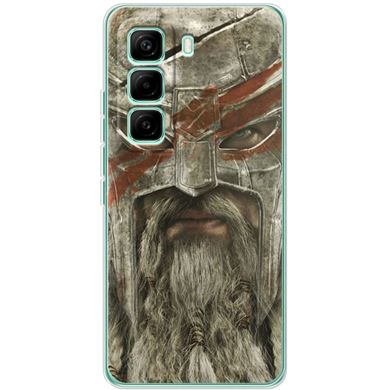 Чохол BoxFace Infinix Hot 60 Pro 